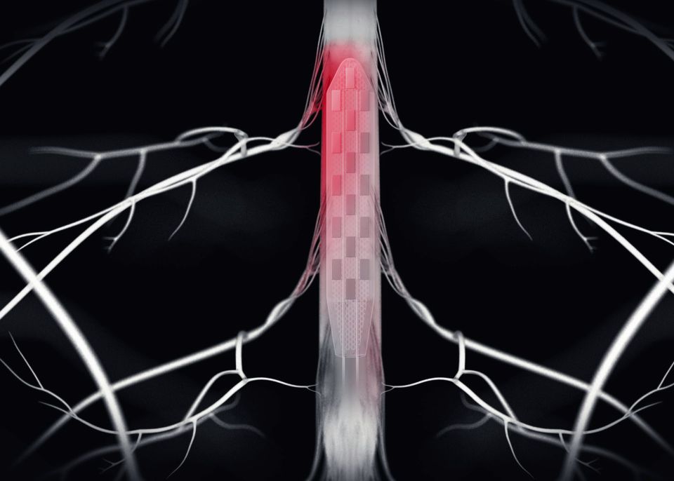 #Neuroscientists from @Inserm, @CNRS and @univbordeaux_EN along with Swiss #researchers and neurosurgeons @EPFL_en @CHUVLausanne @unil have designed and tested a “neuroprosthesis” to treat a #Parkinsons disease patient that restored a fluid walking: u-bordeaux.fr/en/news/major-…