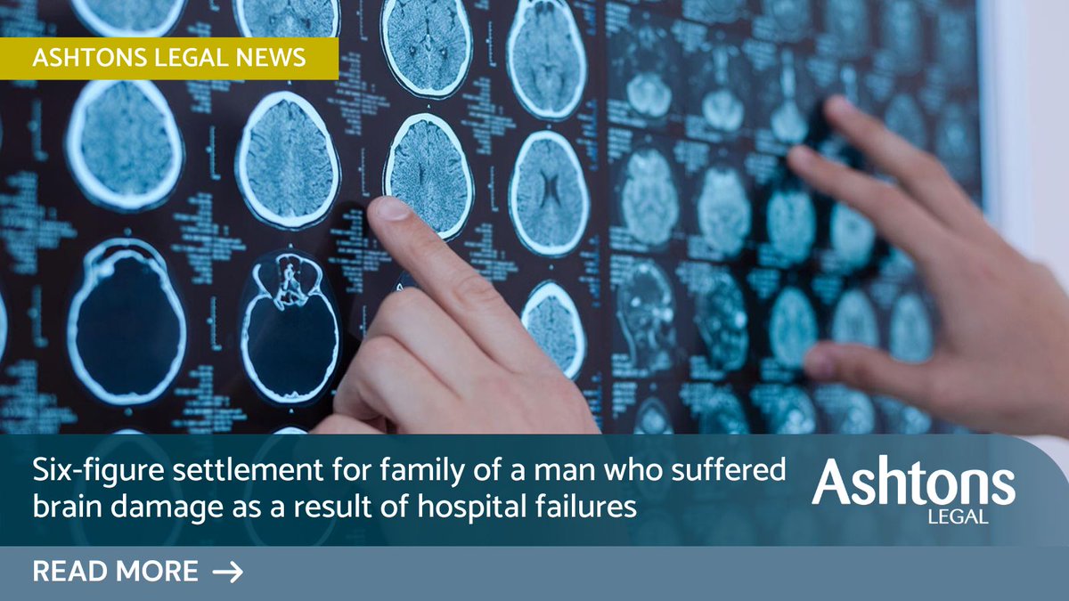 Ashtons Legal LLP (@ashtonslegal) on Twitter photo Tom West, Medical Negligence solicitor, has obtained a six-figure settlement for the family of a man who suffered brain damage as a result of a hospital’s failure to monitor and control his blood pressure: ow.ly/aiQ250Q4UZl #medicalnegligence Tom West, Medical Negligence solicitor, has obtained a six-figure settlement for the family of a man who suffered brain damage as a result of a hospital’s failure to monitor and control his blood pressure: ow.ly/aiQ250Q4UZl #medicalnegligence