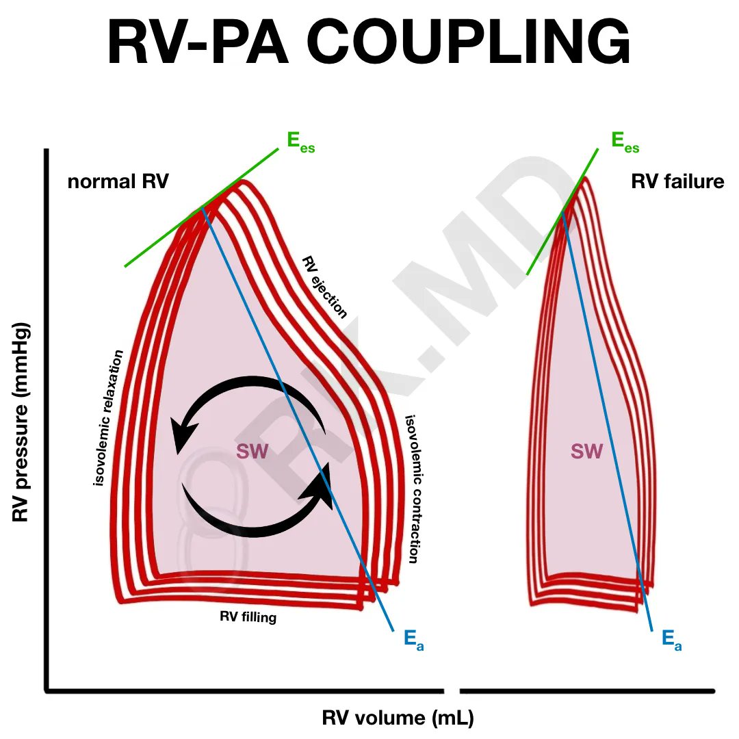 RV-PA coupling utilizes the effective PA elastance (Ea) and the RV end-systolic elastance (Ees). Learn more on the blog! #meded #medtwitter rk.md/2023/right-ven…