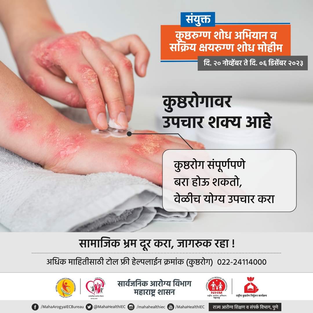 InfoDhule's tweet image. #धुळे
कुष्ठरोग संपूर्णपणे बरा होऊ शकतो, 
वेळीच योग्य उपचार करा..

#leprosy #leprosyawareness #LeprosyDisease #LeprosyEradicationCampaign
