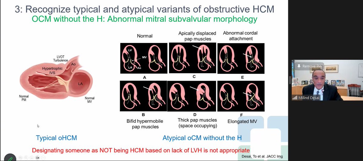 rooshaparikh's tweet photo. Brilliant @StFrancis_LI Cardiovascular Imaging Grand Rounds with @DesaiMilindY talking about the rapidly evolving HCM field which he is leading.#teamapproach
#multimodalityCVImaging
@CleClinicHVTI @CCFcards
@ASE360 @SCMRorg @societyhcm @4hcm
@OKhaliqueMD @DrAllenJ @CHS_LI https://t.co/Gm6Kyk65Jv