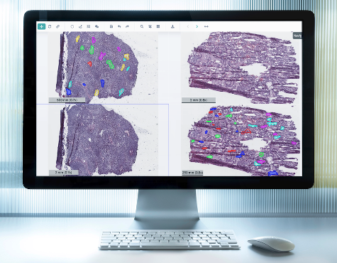 deep_path's tweet photo. Comparison of multiple H&E images is a common requirement when generating annotations necessary for downstream machine learning. PixelView enables Web-based side-by-side image display for collaborative annotation. Free trial available at: https://t.co/saHAJhOGEg https://t.co/OcC566EHxW