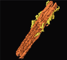 EMDB_EMPIAR's tweet photo. https://t.co/Ppd029qpI4 is high-throughput electron tomography identifying centriole over-elongation in plasma cell disorders. Published @LeukemiaJnl jointly by @SchwabYannick & Kraemer lab's @embl and @DKFZ. #EMPIAR #WeLoveMethodsDevelopmentToo #AnotherDayAnotherCentriol #ssET https://t.co/Gpz8jyEkBo