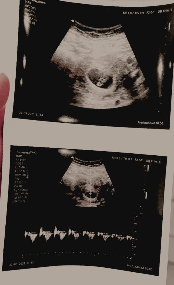 ᅠ⠀ ⠀
ᅠ⠀

ᅠ

⠀⠀⠀    𝑛𝑜𝑤 𝑡𝘩𝑒 𝑤𝑜𝑟𝑙𝑑 𝑖𝑠 𝑎𝑏𝑙𝑒 𝑡𝑜 𝑘𝑛𝑜𝑤...
⠀⠀⠀        𝐚 𝐛𝐚𝐛𝐲 𝐢𝐬 𝐜𝐨𝐦𝐢𝐧𝐠 𝐬𝐨𝐨𝐧
                       I̼'̼M̼ ̼P̼R̼E̼G̼N̼A̼N̼T̼.̼
ᅠ⠀

ᅠ⠀  ⠀⠀⠀⠀

    ⠀⠀