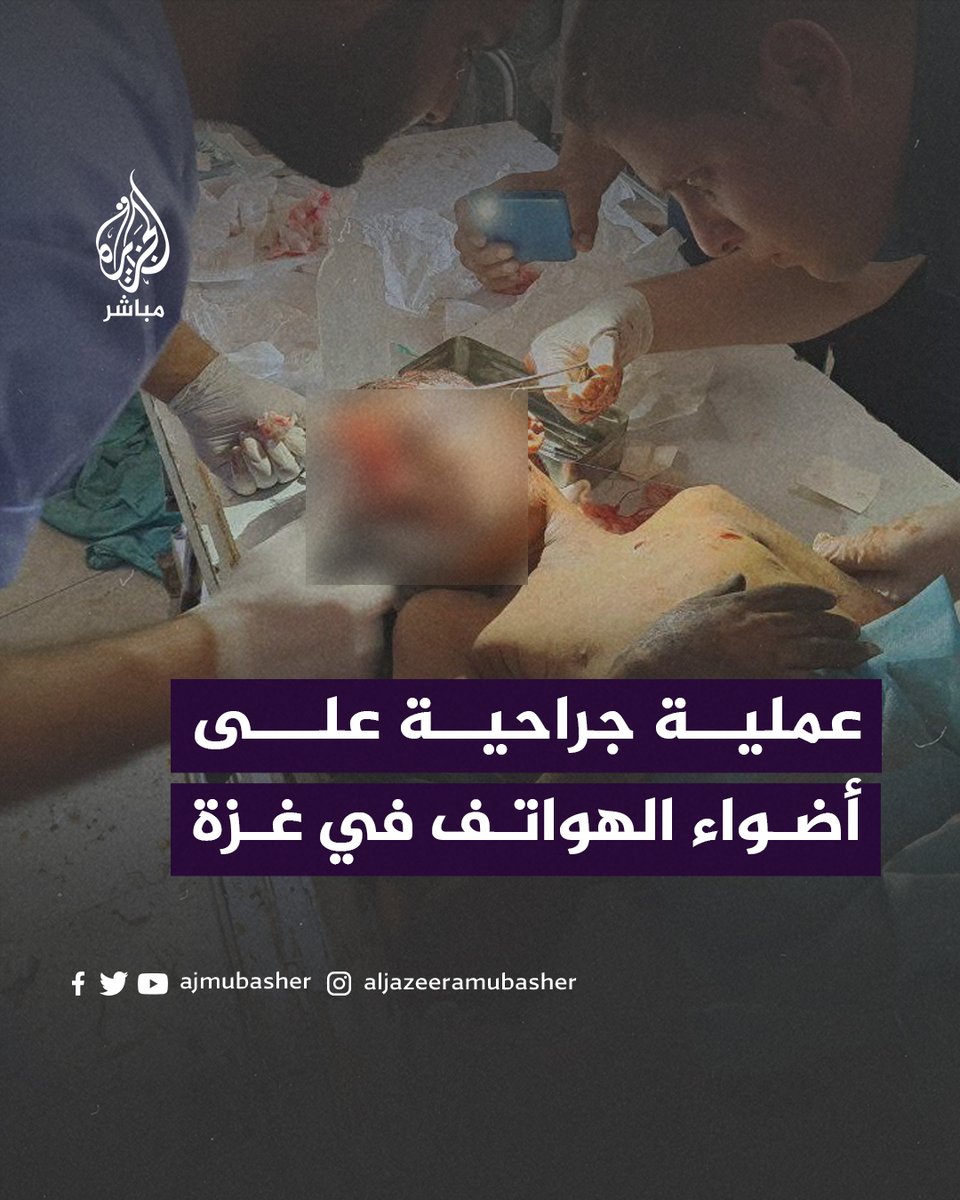 أطباء في قطاع #غزة يجرون عملية جراحية لأحد الأطفال المصابين جراء الغارات الإسرائيلية على أضواء الهواتف المحمولة بسبب انقطاع التيار الكهربائي جراء نقص إمدادات الوقود

#الجزيرة_مباشر #غزة_لحظة_بلحظة