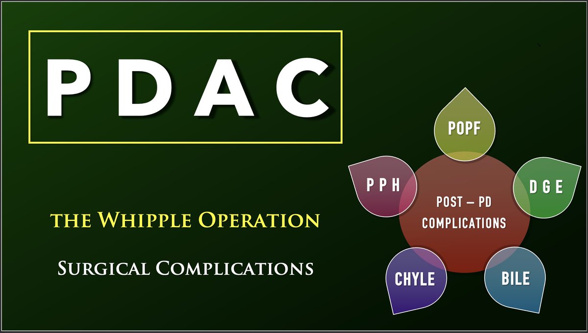 🚨🚨🚨🚨🚨

Are you a pancreatic surgeon managing pancreatic cancers & complex postop issues? 

Or enroute to be one?

This thread is for you! 

🧵🧵🧵

Complications of the #Whipple operation & how best to manage them

#MedTwitter 

#PancreaticCancerAwarenessMonth

@ISGPS_news