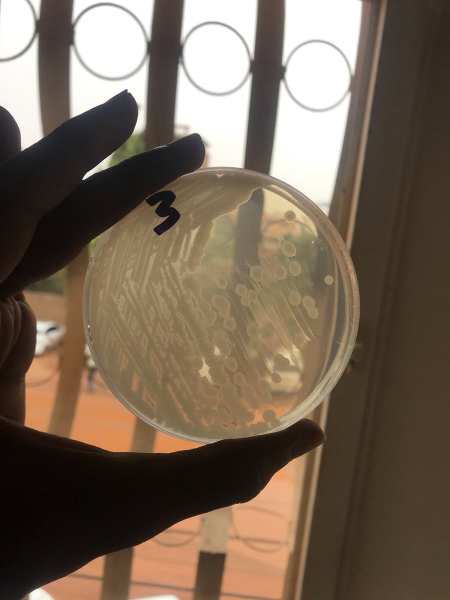 siralkhtim11's tweet photo. This is my streaking 😍🧫
Show me yours👀
#microbiology #microRound #bacteria #bacillus https://t.co/8alH1USR83