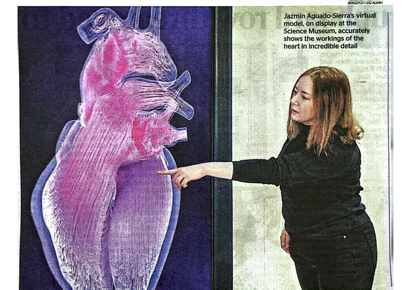 James Drake (@jamesjpdrake) on Twitter photo Scientist Jazmin Aguado-Sierra has created a world-first visualisation of her own heart, which is accurate down to a cellular level.
Technology of this kind could perhaps be used to forecast an individual’s health, and might allow doctors to predict the effects of a drug which Scientist Jazmin Aguado-Sierra has created a world-first visualisation of her own heart, which is accurate down to a cellular level.
Technology of this kind could perhaps be used to forecast an individual’s health, and might allow doctors to predict the effects of a drug which