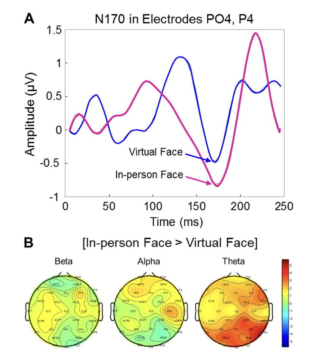 Imaging Neuroscience (@imagingneurosci) on Twitter photo New paper in Imaging Neuroscience <a href="/mitpress/">The MIT Press @mitpress.bsky.social</a> by Nan Zhao, Joy Hirsch, et al:
Separable processes for live “in-person” and live “zoom-like” faces
doi.org/10.1162/imag_a… New paper in Imaging Neuroscience <a href="/mitpress/">The MIT Press @mitpress.bsky.social</a> by Nan Zhao, Joy Hirsch, et al:
Separable processes for live “in-person” and live “zoom-like” faces
doi.org/10.1162/imag_a…