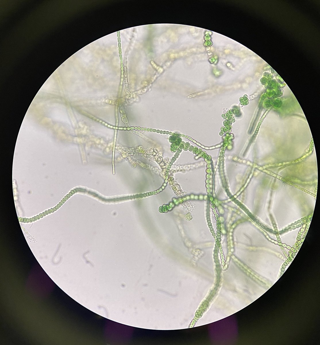 haben heute wieder coole präparate im bio praktikum erstellt und untersucht,
1. Bakterien des Zahnbelags (Zahnplaque)
2. Grampositive (lila) und Gramnegative (pink) Bakterien der Luft  im Praktikumssaal
3. Cyanobakterien Scytonema
4. Cyanobakterien Fischerella