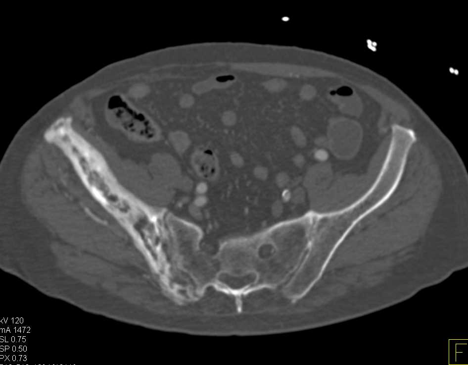 ctisus's tweet photo. Paget's Disease: https://t.co/ZlQsIRyyo9 https://t.co/SlEQLqxtnM