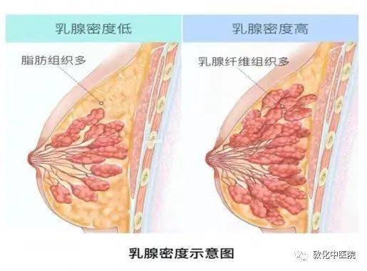 Otk7H's tweet photo. #让乳房变大 part2
乳腺容易改变乳房体积，不代表脂肪细胞没有任何作用，相当于保护组织
所以当乳腺增多增大，脂肪细胞是会自动调节的，不需要肥胖影响
不是脂肪厚于乳腺，或者乳腺多于脂肪，乳腺密度会影响乳房形状
乳腺细胞的变化和受体ERα和ERβ有关
前面提到罩杯极限是因为乳腺管数量是优先发育 https://t.co/kXKgOLCC6g