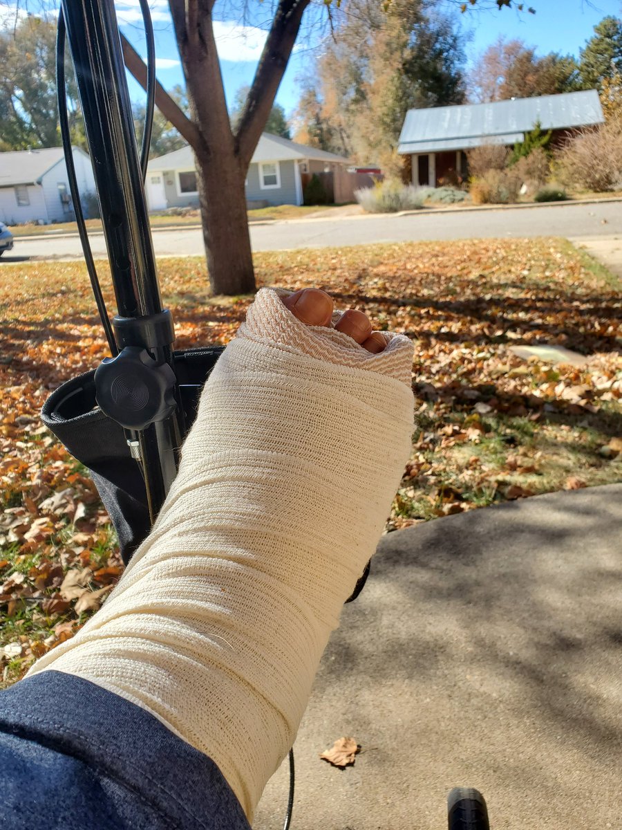u2videoqueen's tweet photo. Me &amp; the ganky foot enjoying the beautiful 73 degree Colorado November day.  73 in Colorado in November?  What the what??? Check with me tomorrow when the snow rolls back in.  #WinterIsComing #springtoday https://t.co/tYC2DV6laz