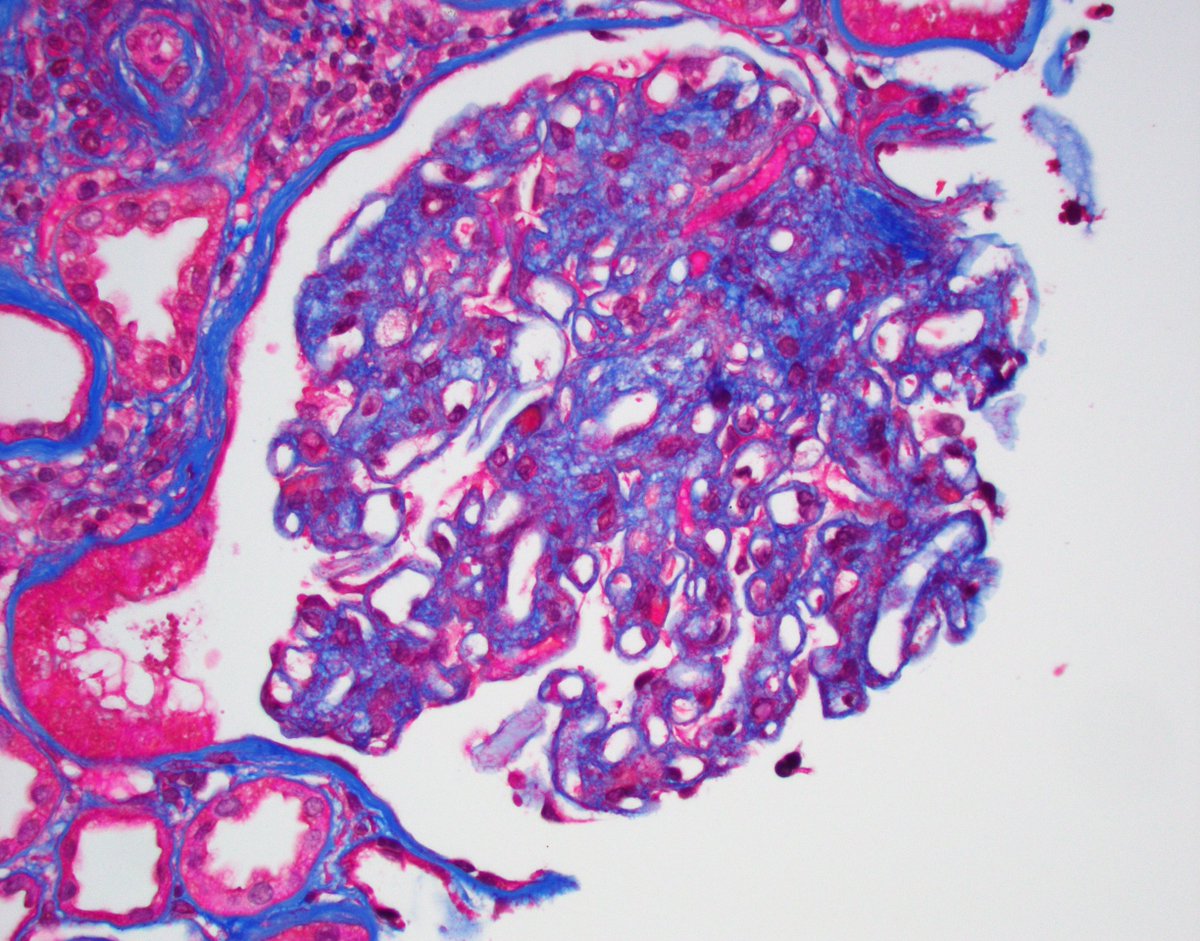 JZRenalPath tweet picture