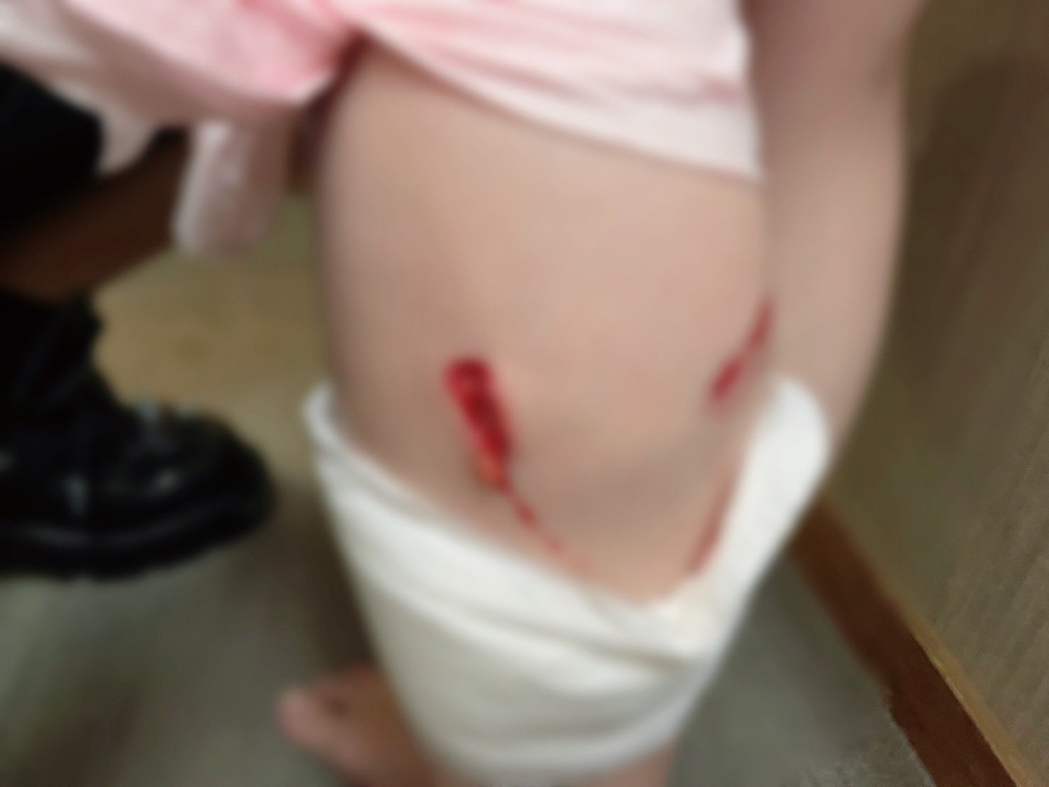 [問卦] 日本女生第一次來台灣就被野狗咬？