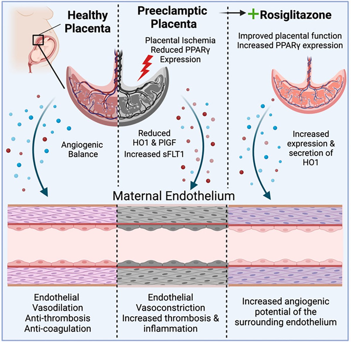 Rosiglitazone can restore critical signaling pathways disrupted in PE. This could be a game-changer for maternal and fetal health. Dive into the details here: #PreeclampsiaResearch #PlacentalHealth #MaternalCare @Drewlolab