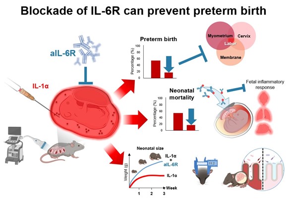 MFariasJofre's tweet image. A new weapon in the fight against prematurity: Check out our new study in @eBiomedicine @TheLancet showing that prenatal blockade of the IL-6 receptor can prevent preterm birth and adverse neonatal outcomes bit.ly/IL6R #NGLLab #CRepHS @WUSTL @WUSTLmed @WashU_OBGYN