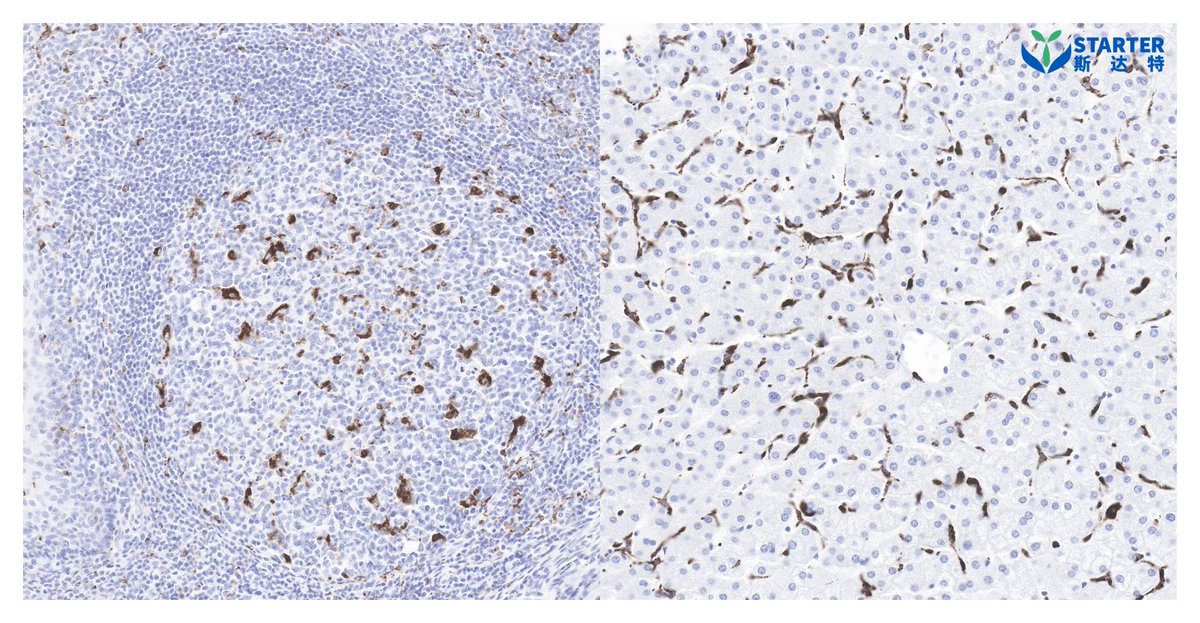 Starterbio's tweet photo. #IHC #antibody #CD68
S-RMab® CD68 Recombinant Rabbit mAb (SDT-R025)
Catalog Number: S0B2064
Location: Membrane, Endosome, Lysosome
Application: IHC-P
Find more: https://t.co/CxMpyWBCub
#biotech #lifescience #CDx #IVD #cancer #pathology https://t.co/258ddjEjD0
