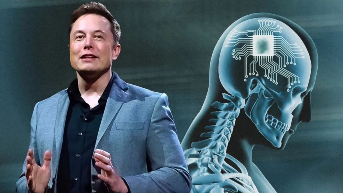 Elon Musk’s company “Neuralink” is looking for a volunteer to have a piece of their skull cut open by a robotic surgeon so it can insert thin wires and electrodes into their brain.