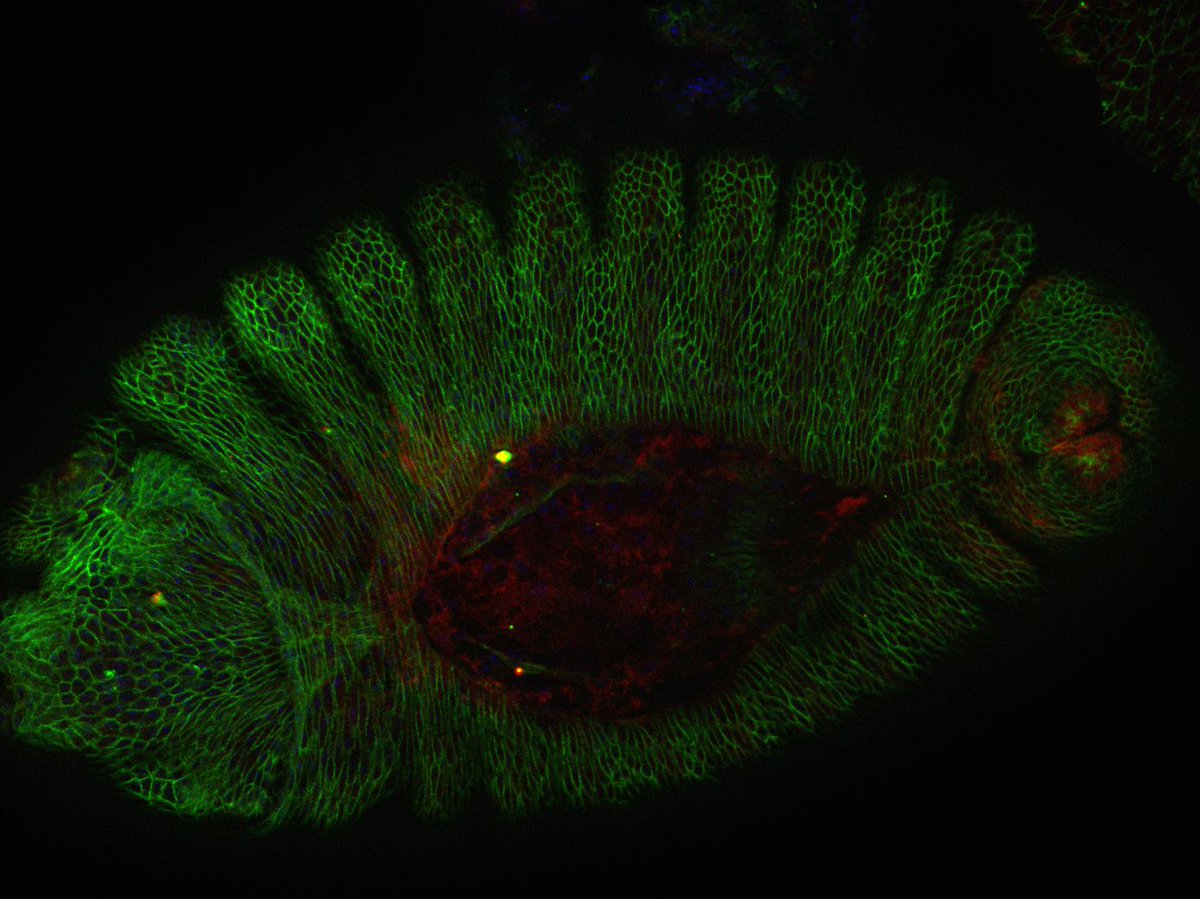 Lauren Anllo (@anllolauren) on Twitter photo Dev Bio lab students did some imaging in the Anllo lab this week! Enjoy this lovely Fas3 stained Drosophila embryo undergoing dorsal closure 🪰🔬<a href="/ECU_Biology/">ECU_Biology</a> <a href="/ECLaserTag/">ECU LaserTAG</a> <a href="/ECUResearch/">ECU Research</a> Dev Bio lab students did some imaging in the Anllo lab this week! Enjoy this lovely Fas3 stained Drosophila embryo undergoing dorsal closure 🪰🔬<a href="/ECU_Biology/">ECU_Biology</a> <a href="/ECLaserTag/">ECU LaserTAG</a> <a href="/ECUResearch/">ECU Research</a>