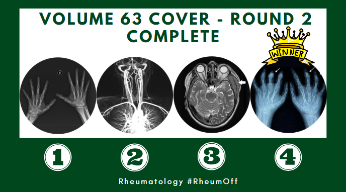 RheumJnl's tweet photo. Round Two Winner!🏆#RheumOff

Radiograph of hands with arthritis mutilans by @joysamanta et al. will be one of three on the cover of Rheumatology Volume 63!⭐

Read the article here👉https://t.co/MXP3iVJCUX https://t.co/FsGEou3T4y
