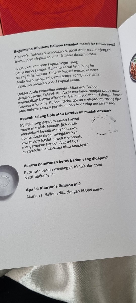 Hari ini ikut training utk balloon intragastric Allurion.
Alat medis berupa balon yg dimasukkan ke dlm lambung, dlm bentuk awal kapsul, trus kapsulnya diisi aqua bidest. Dan balon tsb akan menghuni lambung sekitar 3-4bulan. 

Dengan adanya balon ini, kapasitas lambung akan