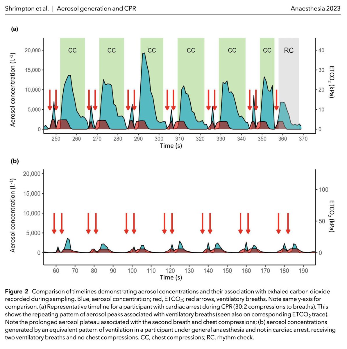 ππ―π’π¦π΄π΅π©π¦π΄πͺπ’ (@anaes_journal) on Twitter photo πCardiopulmonary resuscitation generates 100-fold higher concentrations of respiratory aerosol than in awake or anaesthetised patients.
<a href="/_andyshrimp/">Andy Shrimpton</a> <a href="/vickibrown999/">Vicki Brown</a> <a href="/JerryPNolan/">Jerry Nolan</a> <a href="/jas_soar/">Jasmeet Soar</a> <a href="/gushamilton/">Gus Hamilton</a> <a href="/doctimcook/">Tim Cook</a> <a href="/TonyPi314/">Tony</a> <a href="/drjulesbrown/">Jules Brown</a>
πβ¦-publications.onlinelibrary.wiley.com/doi/full/10.11β¦ πCardiopulmonary resuscitation generates 100-fold higher concentrations of respiratory aerosol than in awake or anaesthetised patients.
<a href="/_andyshrimp/">Andy Shrimpton</a> <a href="/vickibrown999/">Vicki Brown</a> <a href="/JerryPNolan/">Jerry Nolan</a> <a href="/jas_soar/">Jasmeet Soar</a> <a href="/gushamilton/">Gus Hamilton</a> <a href="/doctimcook/">Tim Cook</a> <a href="/TonyPi314/">Tony</a> <a href="/drjulesbrown/">Jules Brown</a>
πβ¦-publications.onlinelibrary.wiley.com/doi/full/10.11β¦