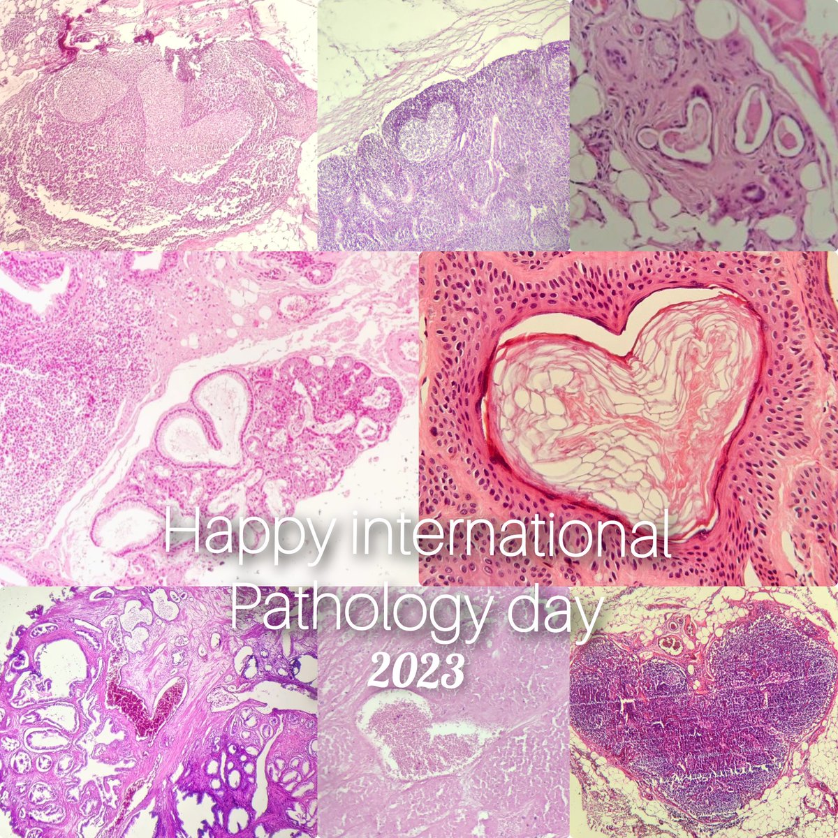 Happy international pathology day  🩷 🔬
#PathTwitter #pathart  #IPD2023