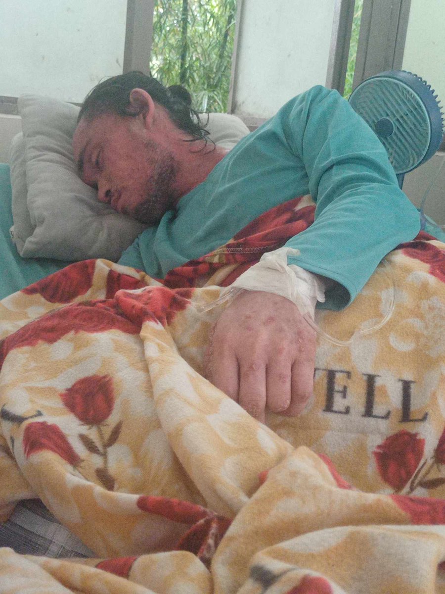 PhReactor's tweet photo. Good day to everyone, I'm REACTOR PH OFFICIAL's brother, I'm asking for a little help from you to meet his needs with his current illness of pneumonia and psoriasis,, for those who want to give help, just send it here to my gcash account (09755018141 cheryl ayala) For the intern https://t.co/FUICt3g9ab