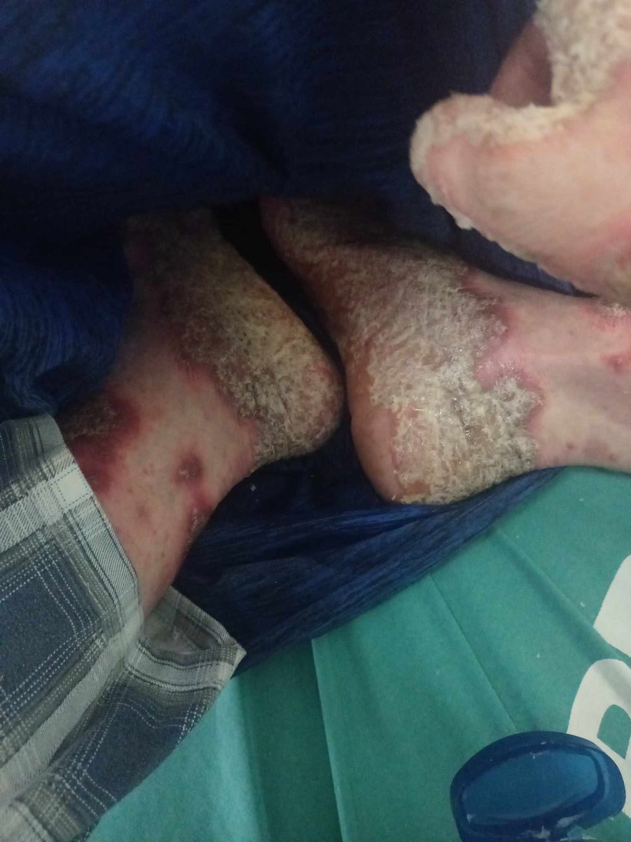 PhReactor's tweet photo. Good day to everyone, I'm REACTOR PH OFFICIAL's brother, I'm asking for a little help from you to meet his needs with his current illness of pneumonia and psoriasis,, for those who want to give help, just send it here to my gcash account (09755018141 cheryl ayala) For the intern https://t.co/FUICt3g9ab