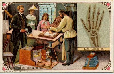 #internationaldayofradiology is the perfect time to recall the huge contributions and sacrifices of early #radiology pioneers like W.C. Roentgen and Thomas Edison. History expert Dr. Adrian Thomas tells the story. buff.ly/47mFzDp #IDOR #IDOR2023