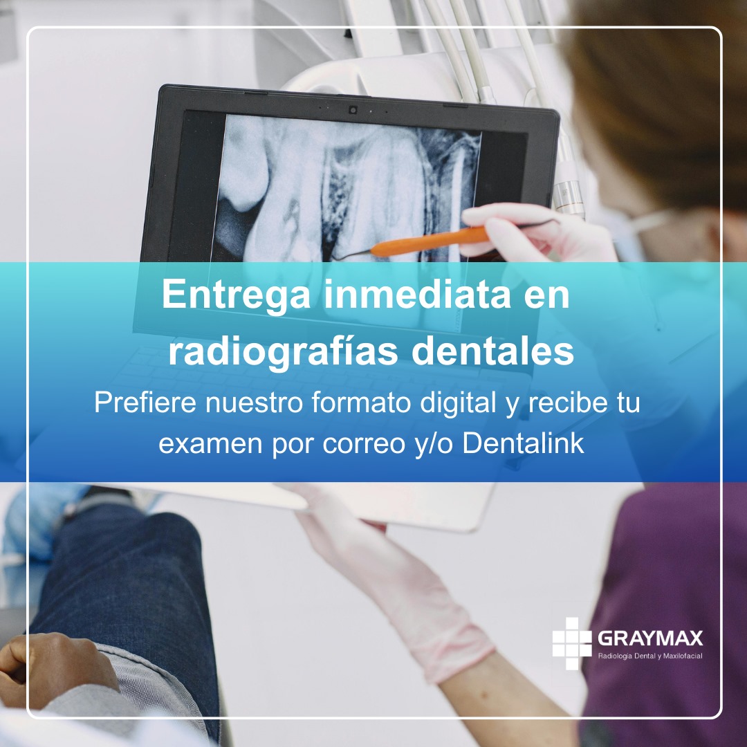 graymax_cl's tweet image. Somos tu mejor opción en Radiografías Dentales 🙌🏻😃
#RadioGrafía #radiologia #dental #Miercoles #xray #providencia