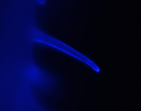 Chenxin Li, PhD (@chenxinli2.bsky.social) tweet media