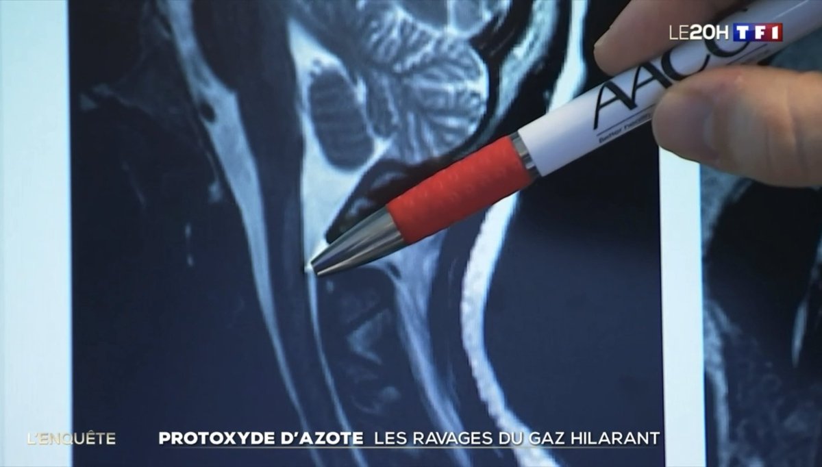 GrzychGuillaume's tweet image. Nouveau reportage au 20h de @TF1 sur les ravages du protoxyde et les travaux de @FiliereProto du @CHU_Lille @ARS_HDF @ARS_IDF