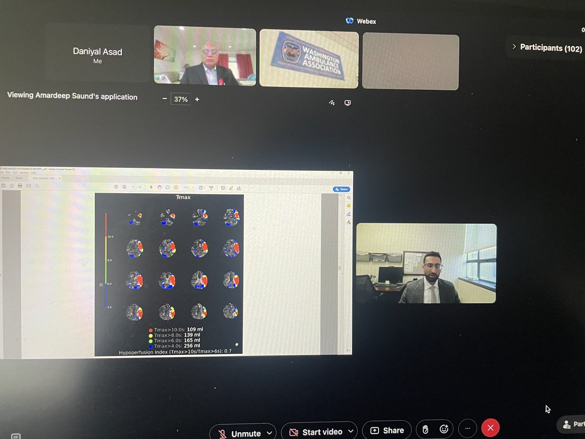 UCONN Stroke Fellowship Program (@hhneurovascular) on Twitter photo Fantastic talk on Mechanical Thrombectomy to statewide EMS by our amazing stroke fellow Dr.Saund! 🧠 🩸 🏥 <a href="/ajaytunguturi/">Ajay Tunguturi</a> <a href="/UConnNeurology/">UConn Neurology Residency</a> <a href="/EricaSchuyler/">Erica A Schuyler, MD, FAAN, FANA</a> <a href="/TapanMe26854484/">TapanMehta</a> <a href="/karantarasaria/">Karan Tarasaria</a> <a href="/daniyal_asad/">Daniyal Asad</a> Fantastic talk on Mechanical Thrombectomy to statewide EMS by our amazing stroke fellow Dr.Saund! 🧠 🩸 🏥 <a href="/ajaytunguturi/">Ajay Tunguturi</a> <a href="/UConnNeurology/">UConn Neurology Residency</a> <a href="/EricaSchuyler/">Erica A Schuyler, MD, FAAN, FANA</a> <a href="/TapanMe26854484/">TapanMehta</a> <a href="/karantarasaria/">Karan Tarasaria</a> <a href="/daniyal_asad/">Daniyal Asad</a>