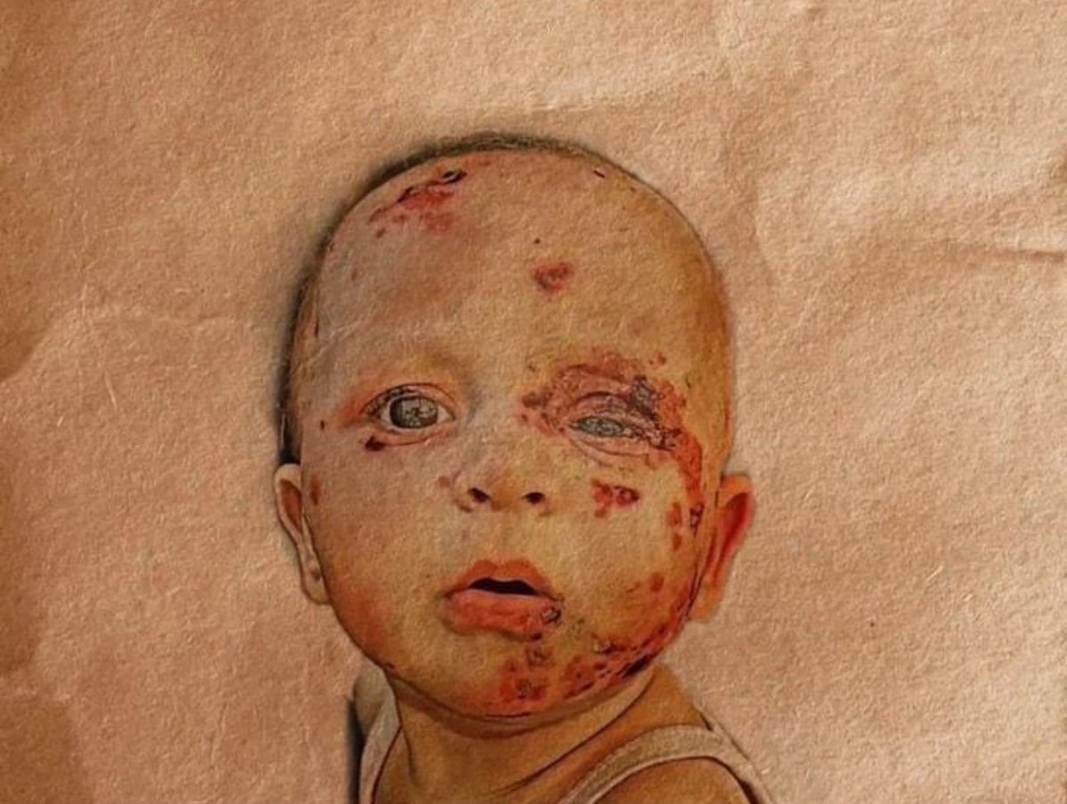 لن ننسى .. 💔🇵🇸