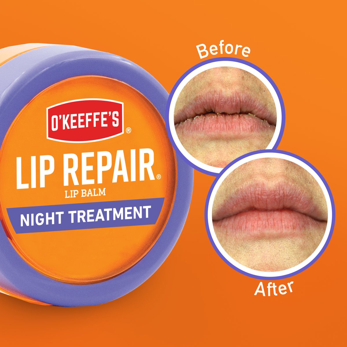 When your lips need an extra boost of moisture, O'Keeffe's Lip Repair Night Treatment is an intense, restorative lip balm that works while you sleep. 

#liprepair #liprepairnighttreatment #okeeffes #lipbalm #lipcare #drylips #crackedlips