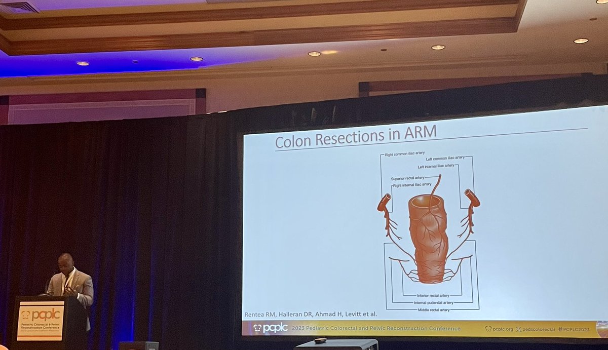 Great presentation by <a href="/GoetoD/">Goeto Dantes, MD</a> on colorectal resections in pediatric ARM at #PCPLC2023