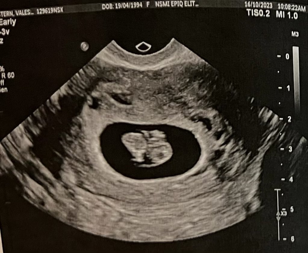 dazza95_'s tweet photo. Baby Zimelstern, debuting 2024 https://t.co/48mFZaWTBq