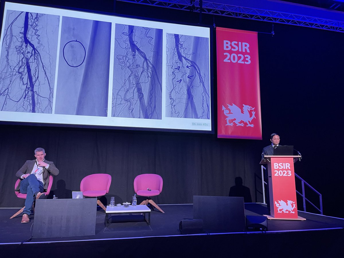 Shahid Seedat (@shahid_seedat) on Twitter photo Hull’s very own <a href="/ragsxray/">Raghu</a> imparting his expertise on crossing complex lesions at the BSIR ASM
#BSIR2023
<a href="/HullRadiology/">HullRadiology</a> <a href="/HullHospitals/">Hull University Teaching Hospitals NHS Trust</a> Hull’s very own <a href="/ragsxray/">Raghu</a> imparting his expertise on crossing complex lesions at the BSIR ASM
#BSIR2023
<a href="/HullRadiology/">HullRadiology</a> <a href="/HullHospitals/">Hull University Teaching Hospitals NHS Trust</a>