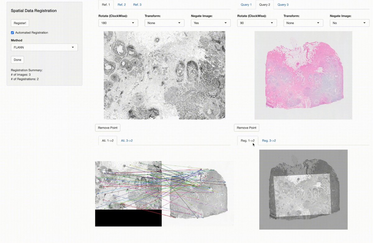 🚀 Exciting update from VoltRon! Automated image alignment across Visium and Xenium platforms is now possible. 🧬💻 @10xGenomics #spatialbiology @opencvlibrary bioinformatics.mdc-berlin.de/VoltRon/regist…