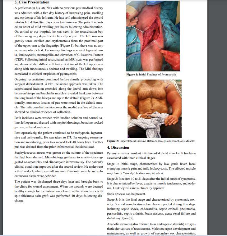 AnnalsMedical's tweet image. #Pyomyositis; A Rare but Dangerous Adverse Effect of Anabolic Steroids was written by Kostidou E.