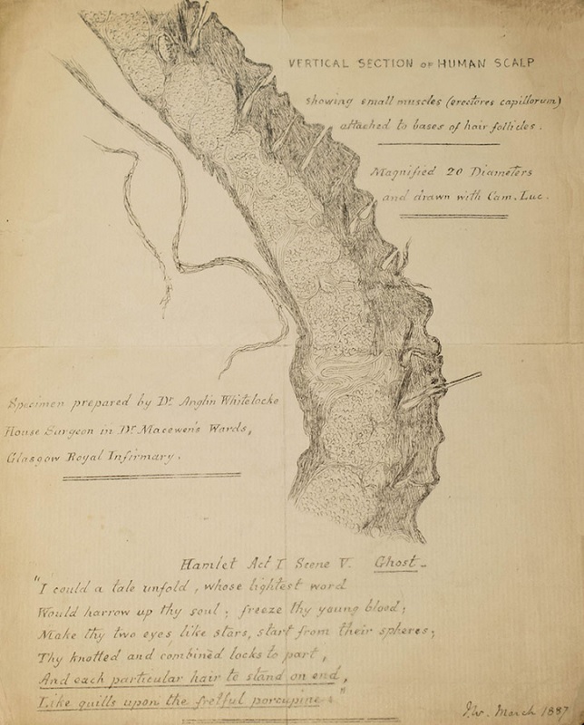 RCPSGheritage's tweet photo. "I could a tale unfold..."

That Shakespeare gets everywhere!

This beautiful sketch of a section of the human scalp is accompanied by a quote from Hamlet! The specimen was prepared by Dr Anglin Whitelocke (1861-1927), surgeon at Glasgow Royal Infirmary.

#shakespeareday #anatomy https://t.co/EVFSy0dDam