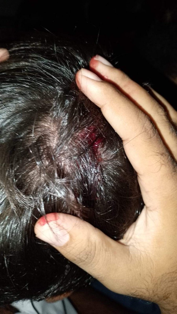 jamiat_pu_'s tweet photo. Such brutal behavior with the future of Pakistan is unacceptable. This is the violation of human rights and may cause to a choas in the society. Punjab Police must release innocent students as soon as possible.
@OfficialDPRPP
#PU_Students_are_Not_Terrorists https://t.co/8ZpD5jtBAR
