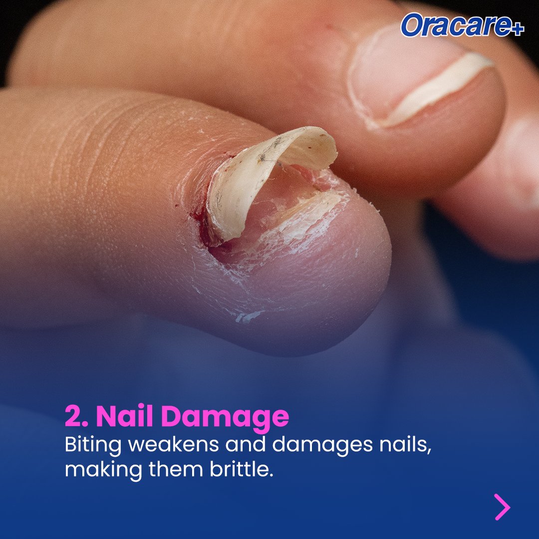 OracarePlus's tweet photo. Hope you learnt something, today? Make the switch to better oral care habits for a healthier smile.π
#Oracare
#TotalOralProtection
#wecareaboutyoursmile https://t.co/6haBiDDWnp