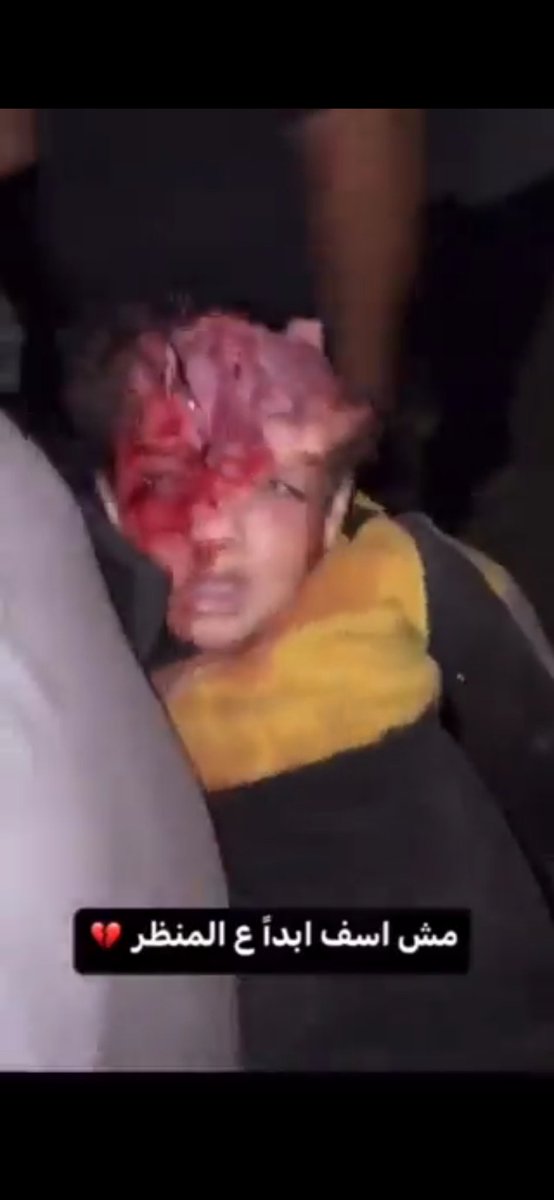 Yorumsuz #IsraelisaGenocidalState