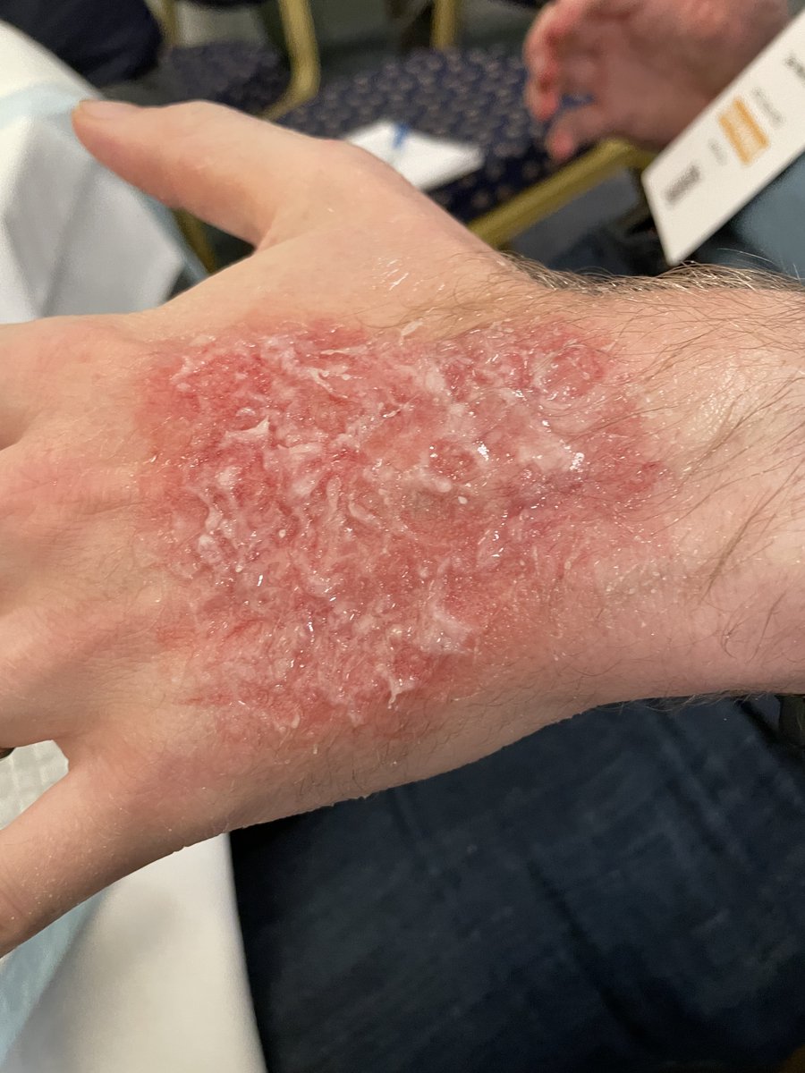 NHSGGC Simulation tweet media