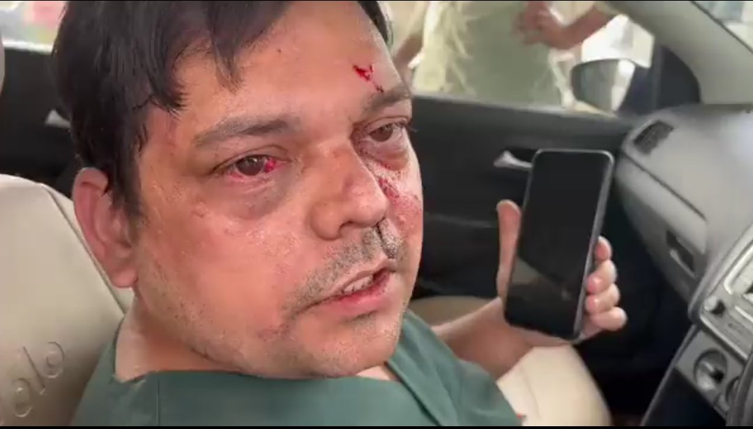 ये गाजियाबाद के एक सम्माननीय डाक्टर हैं। कुमार विश्वास के सिक्योरिटी गार्ड ने साइड ना मिलने पे इन्हें बुरी तरह पीटा है। सबसे पहले तो  कोई पूछे को कुमार विश्वास को सुरक्षा चाहिए किस से ? किस बात के VIP हैं ये ?