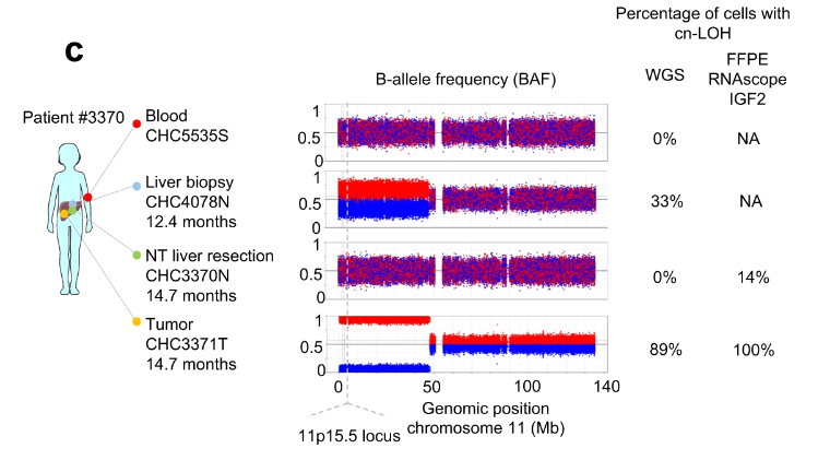 Nature Communications (@naturecomms) on Twitter photo <a href="/Zucmanrossi/">Jessica Zucman-Rossi</a> lab show that 11p15.5 mosaic alteration in the liver is associated with #hepatoblastoma and identify an altered zonation in the #liver of these patients
#CancerResearch @natrescancer @CRCordeliers
nature.com/articles/s4146… <a href="/Zucmanrossi/">Jessica Zucman-Rossi</a> lab show that 11p15.5 mosaic alteration in the liver is associated with #hepatoblastoma and identify an altered zonation in the #liver of these patients
#CancerResearch @natrescancer @CRCordeliers
nature.com/articles/s4146…