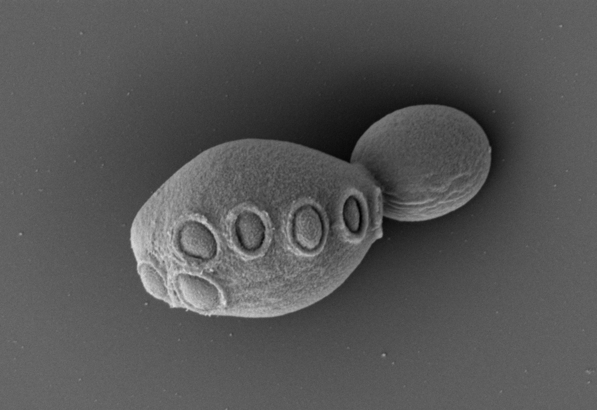 #Yeast cell created with an over 50% synthetic #genome can survive and replicate similar to wild type.

See below a collection of papers presenting this half-synthetic yeast and showcasing the #SyntheticYeastGenomeProject (Sc2.0) <a href="/yeastgenome/">SGD Project @yeastgenome@genomic.social (bsky too)</a> 🧵